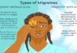 Migraines-are-more-common-in-women-newsasia24